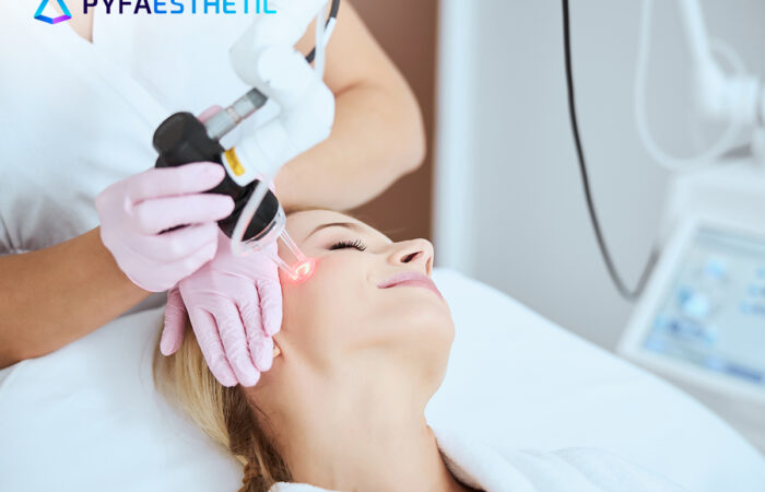 Laser CO2- Carboxy Therapy untuk Kulit Glowing dan Awet Muda