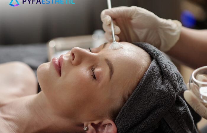 Kapan Waktu yang Tepat untuk Peeling