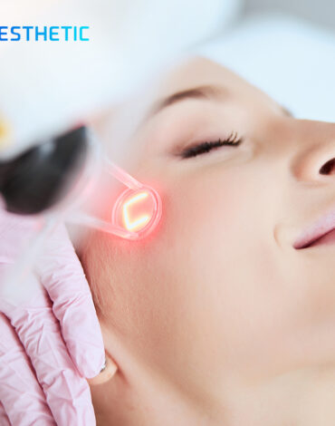 Kenyamanan Terapi CO2 Carboxy