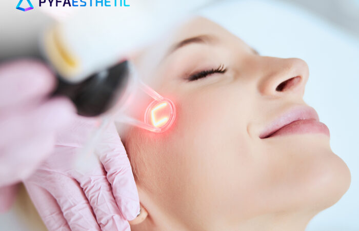 Kenyamanan Terapi CO2 Carboxy