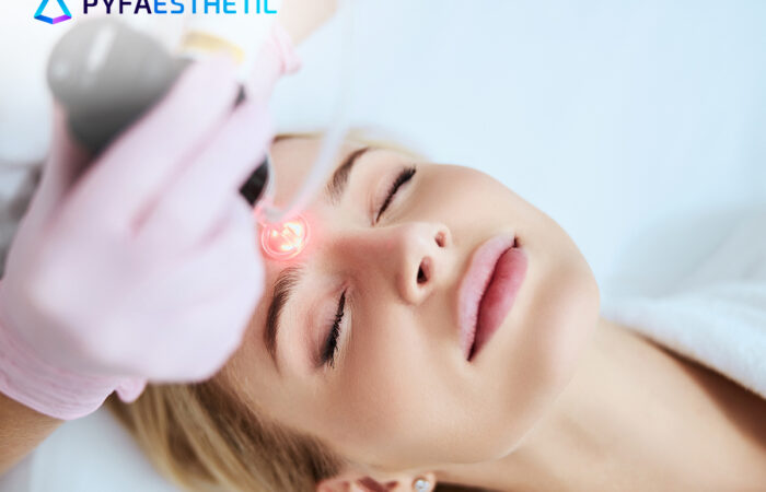 Keunggulan CO2 Carboxy Sound