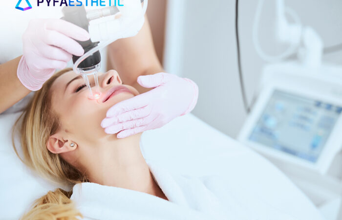 Manfaat Terapi CO2 Carboxy